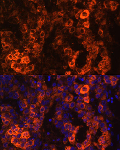 Anti-BHMT Antibody (CAB1216)