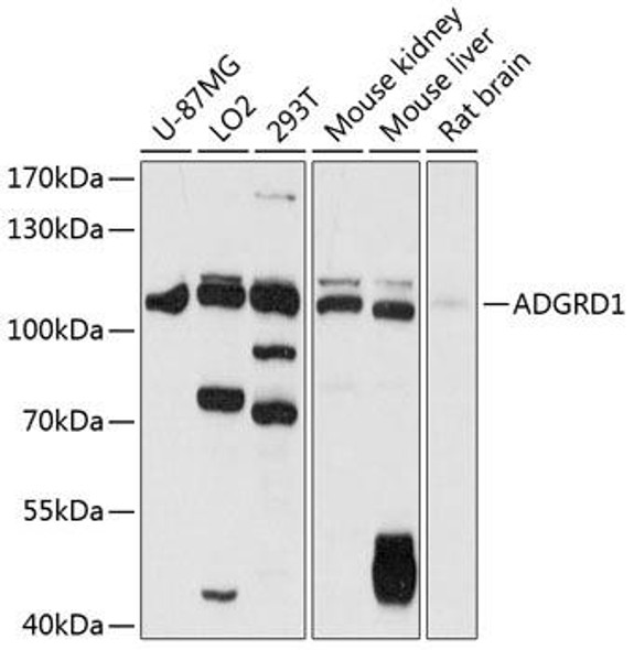 Anti-ADGRD1 Antibody (CAB12629)