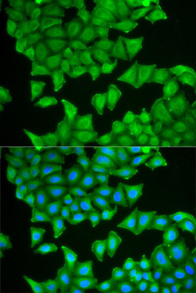 Anti-PTGES3 Antibody (CAB13399)