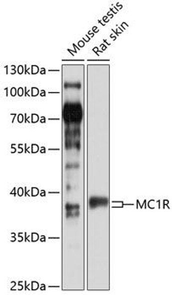 Anti-MC1R Antibody (CAB13512)