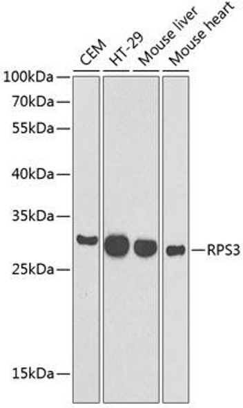 Anti-RPS3 Antibody (CAB13543)