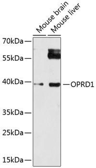 Anti-OPRD1 Antibody (CAB14207)