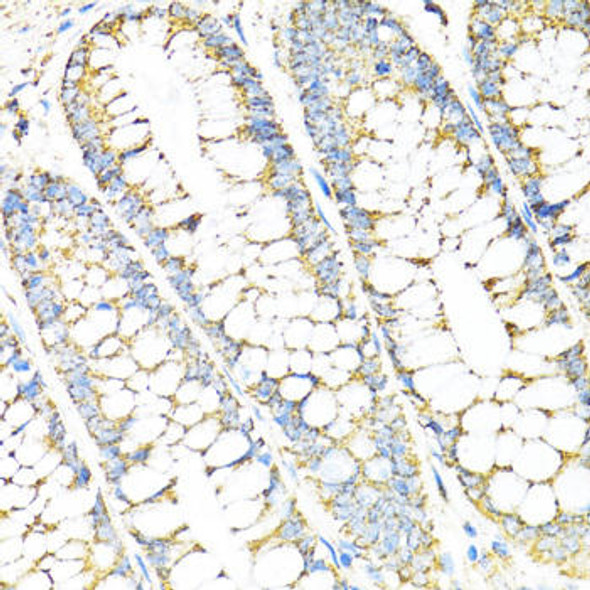 Anti-SERPINE1 Antibody (CAB14758)