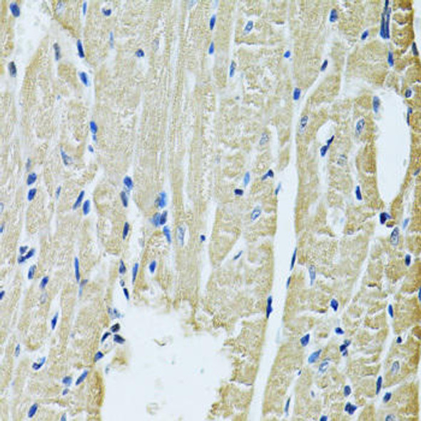 Anti-SLC5A6 Antibody (CAB14814)