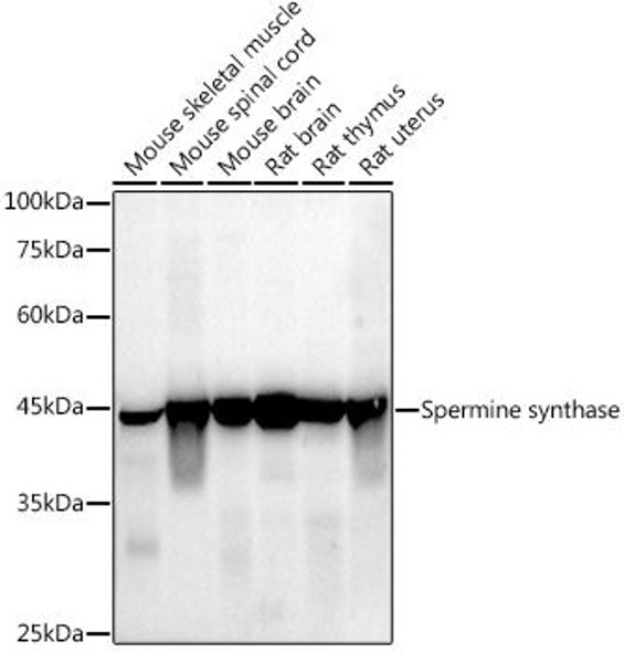 Spermine synthase Monoclonal Antibody (CAB9380)