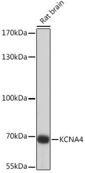 Anti-KCNA4 Antibody (CAB16390)