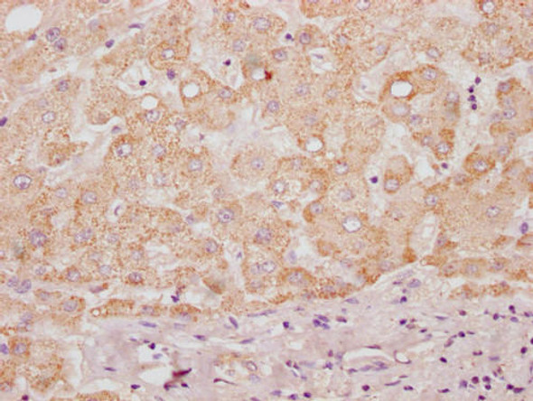 HS3ST3B1 Antibody (PACO64781)