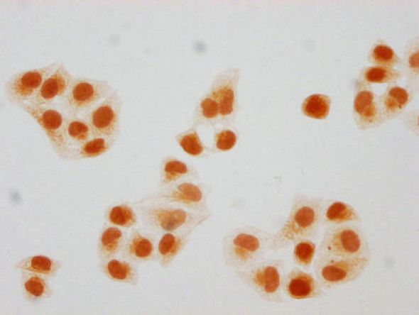 2-hydroxyisobutyryl-HIST1H2BC (K108) Antibody (PACO65130)
