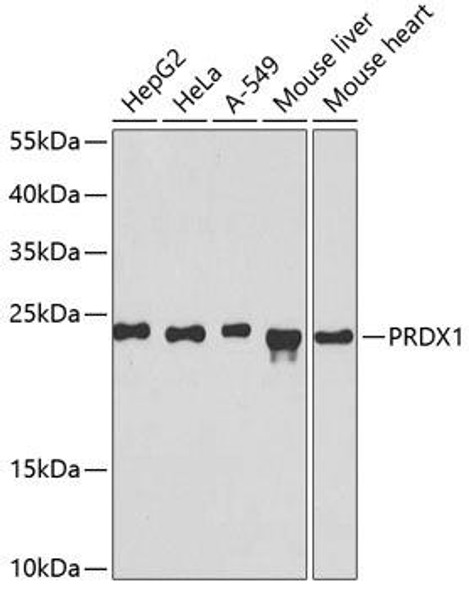 Anti-PRDX1 Antibody (CAB1842)
