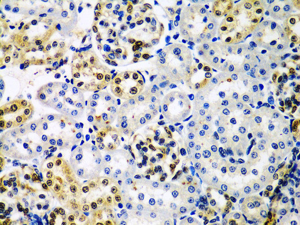 Anti-HDAC2 Antibody (CAB2084)