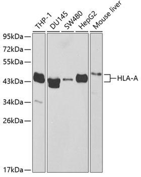 Anti-HLA-A Antibody (CAB2167)