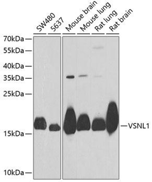 Anti-VSNL1 Antibody (CAB6999)
