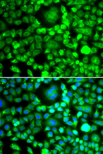 Anti-BLID Antibody (CAB7275)