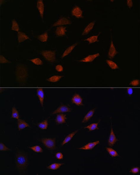 Anti-PDCD5 Antibody (CAB7298)