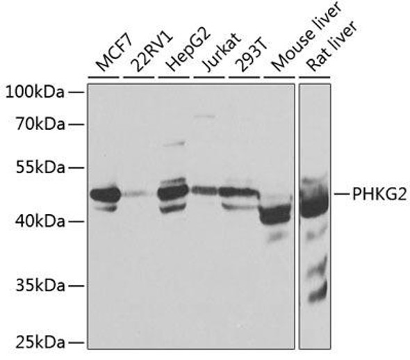 Anti-PHKG2 Antibody (CAB7337)