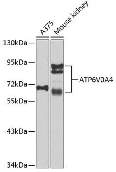 Anti-ATP6V0A4 Antibody (CAB7591)