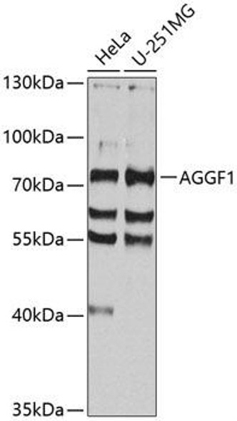 Anti-AGGF1 Antibody (CAB8228)