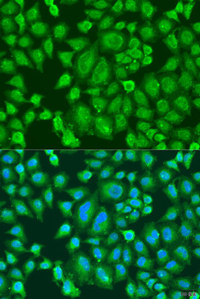 Anti-PARL Antibody (CAB8232)