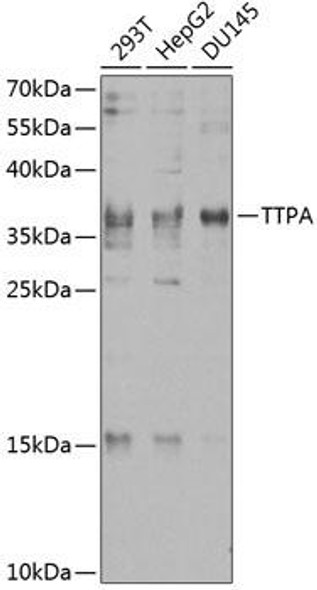 Anti-TTPA Antibody (CAB8562)