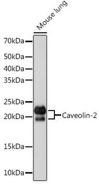 Anti-Caveolin-2 Antibody (CAB4890)