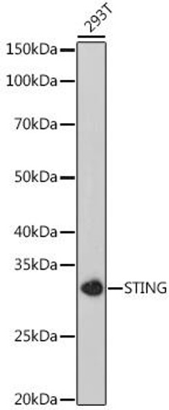 Anti-STING Antibody (CAB20175)