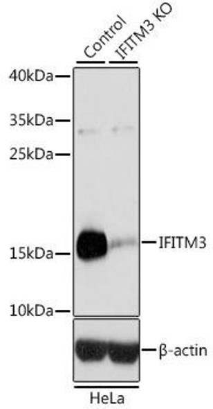 Anti-IFITM3 Antibody (CAB13070)[KO Validated]