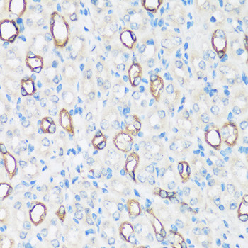 AQP2 Polyclonal Antibody (CAB12998)