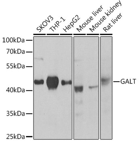 GALT Polyclonal Antibody (CAB21426)