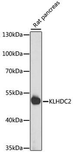 Anti-KLHDC2 Antibody (CAB15147)