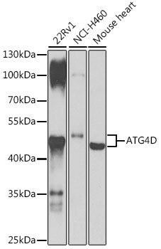 ATG4D Polyclonal Antibody (CAB21690)
