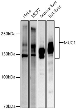 MUC1 Polyclonal Antibody (CAB21726)
