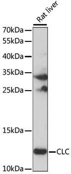 Anti-CLC Antibody (CAB15264)