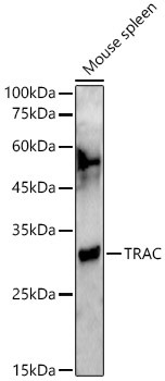 TRAC Polyclonal Antibody (CAB22122)