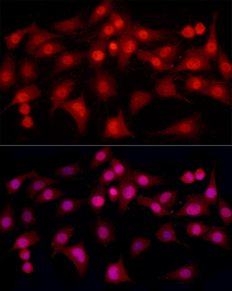 ESRα Monoclonal Antibody (CAB22181)