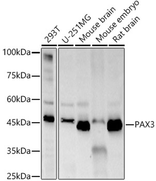 PAX3 Monoclonal Antibody (CAB22293)