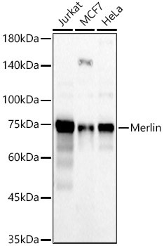 Merlin Polyclonal Antibody (CAB22558)