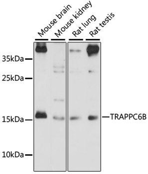 Anti-TRAPPC6B Antibody (CAB15561)