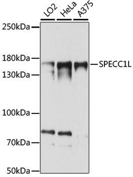 Anti-SPECC1L Antibody (CAB15798)