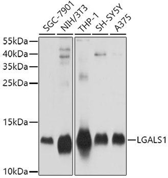 Anti-LGALS1 Antibody (CAB1580)