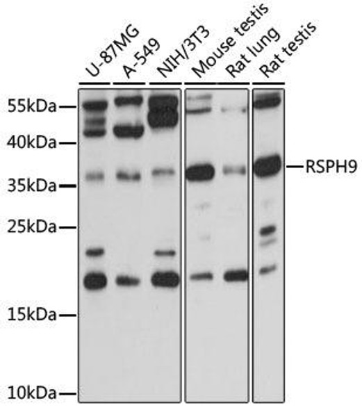 Anti-RSPH9 Antibody (CAB15972)