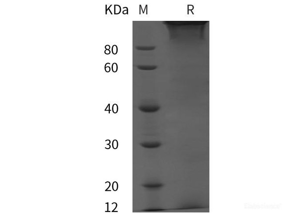 Human FBLN2 Recombinant Protein (His tag) (RPES6010)