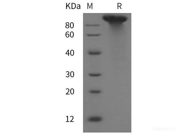 Mouse LDLR Recombinant Protein (His tag) (RPES6099)