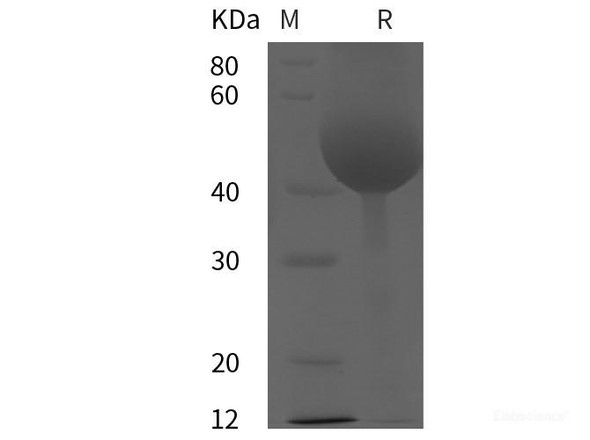 Rat Tissue factor/TF Recombinant Protein (His tag) (RPES6152)