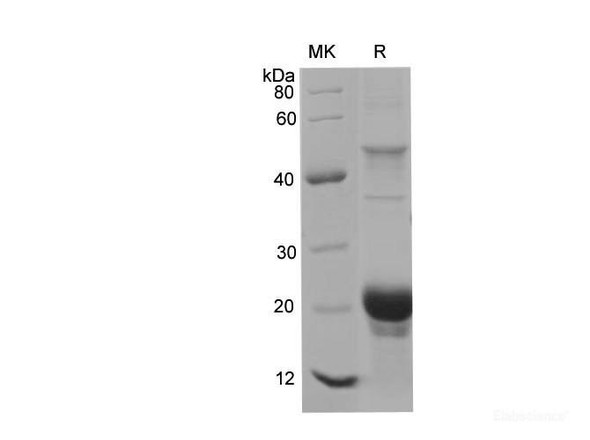 Human IFNAR1 Recombinant Protein (His Tag) (RPES6177)