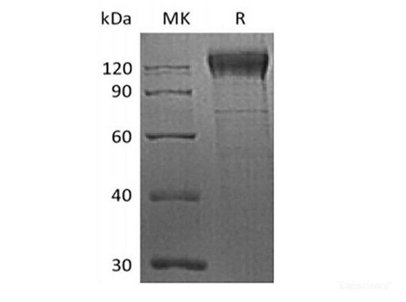 Recombinant Human Integrin Beta-1/ITGB1 (C-6His) (RPES6193)
