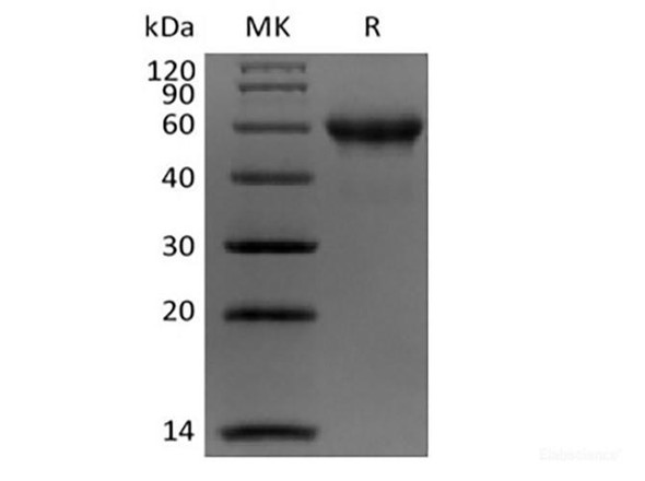 Recombinant Human Carbonic Anhydrase IX/CA9 (C-Avi-6His) Biotinylated (RPES6214)