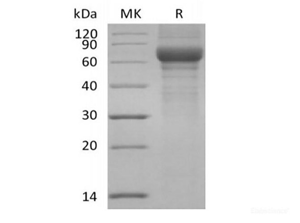 Recombinant Human Vitronectin/VTN (N-Truncated, C-6His) (RPES6218)
