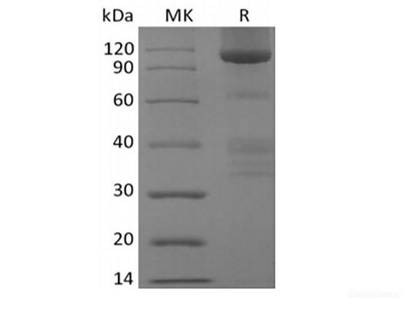 Recombinant Human Glypican-3/GPC3/OCI5 (C-Fc) (RPES6243)