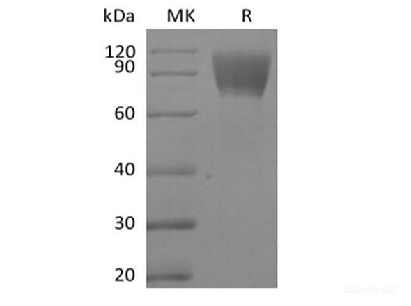 Recombinant Human CA125/MUC16 (C-Fc-Avi) Biotinylated (RPES6261)