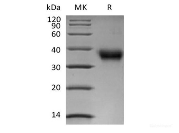 Recombinant Human Folate Receptor  alpha/FOLR1 (C-6His-Avi) Biotinylated (RPES6274)